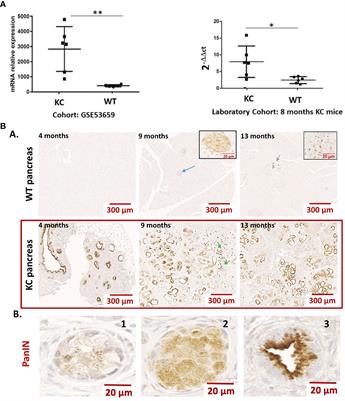 A novel anti-galectin-9 immunotherapy limits the early progression of pancreatic neoplastic lesions in transgenic mice